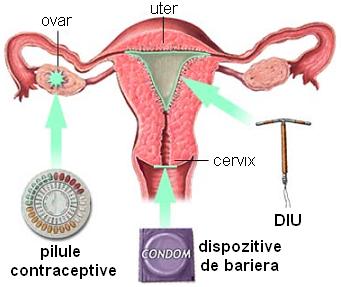 contraceptia dupa avort